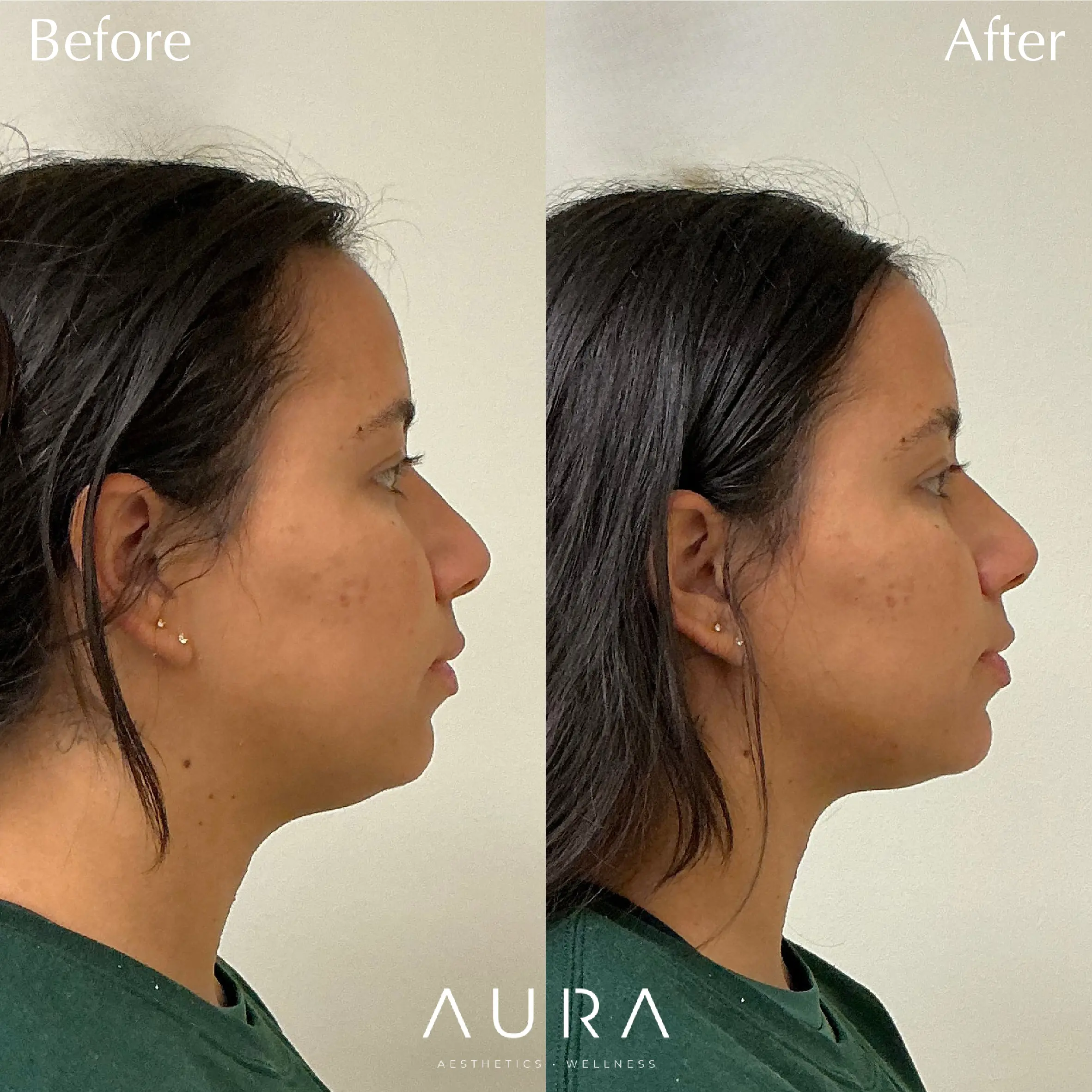 Facial Balancing