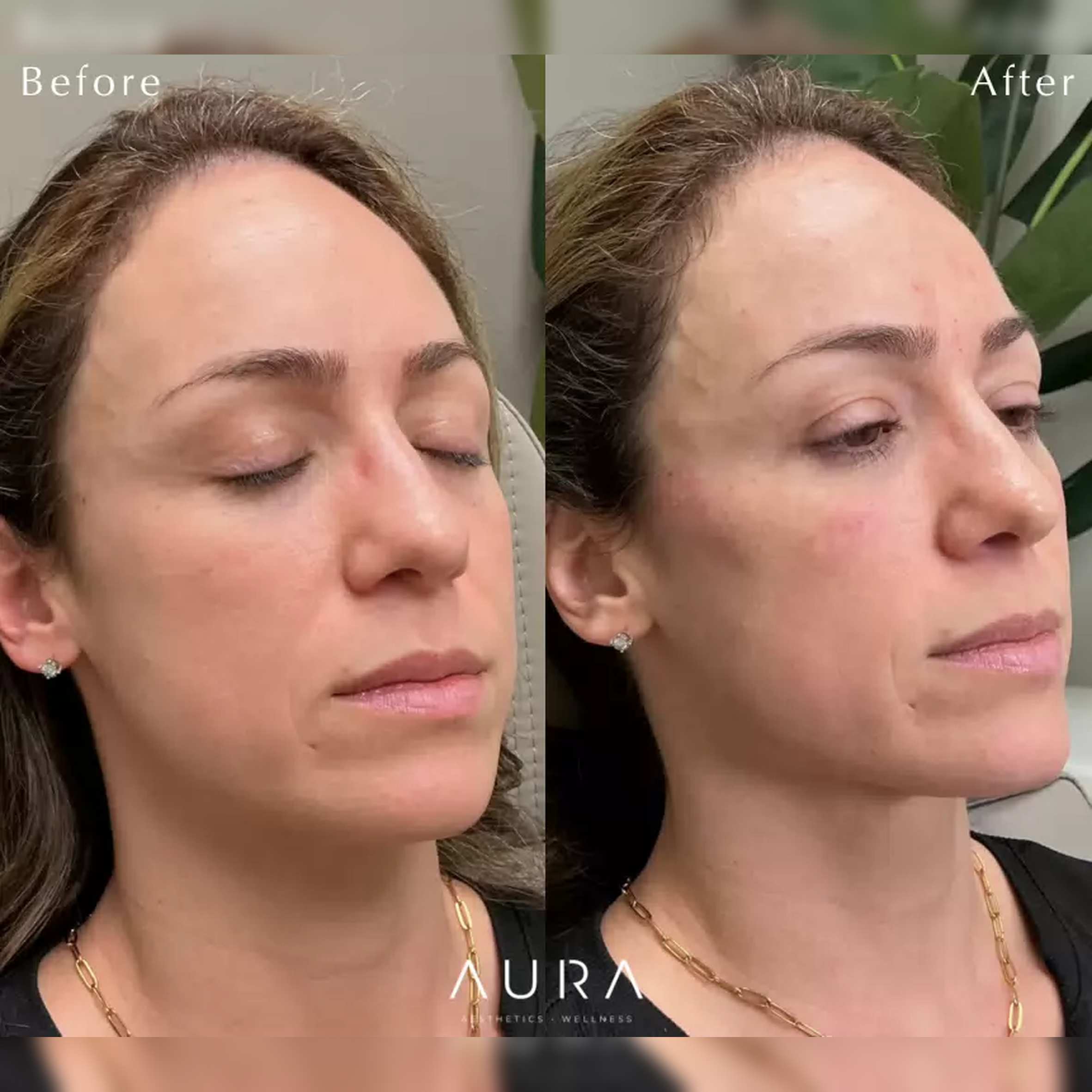 Facial Balancing1