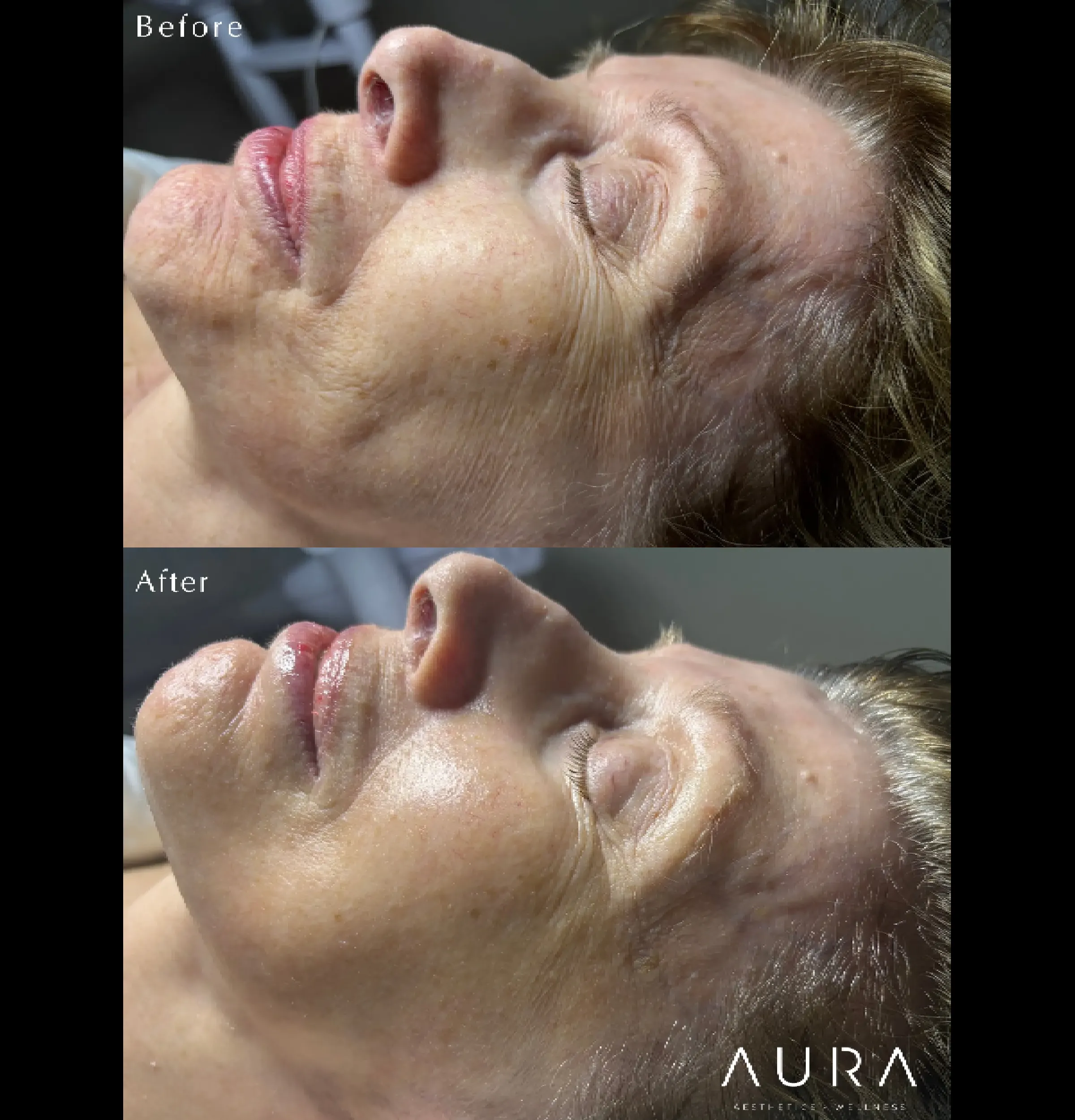 Facial1