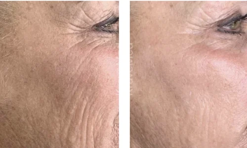 SKIN REJUVENATIONin Bellaire, TX